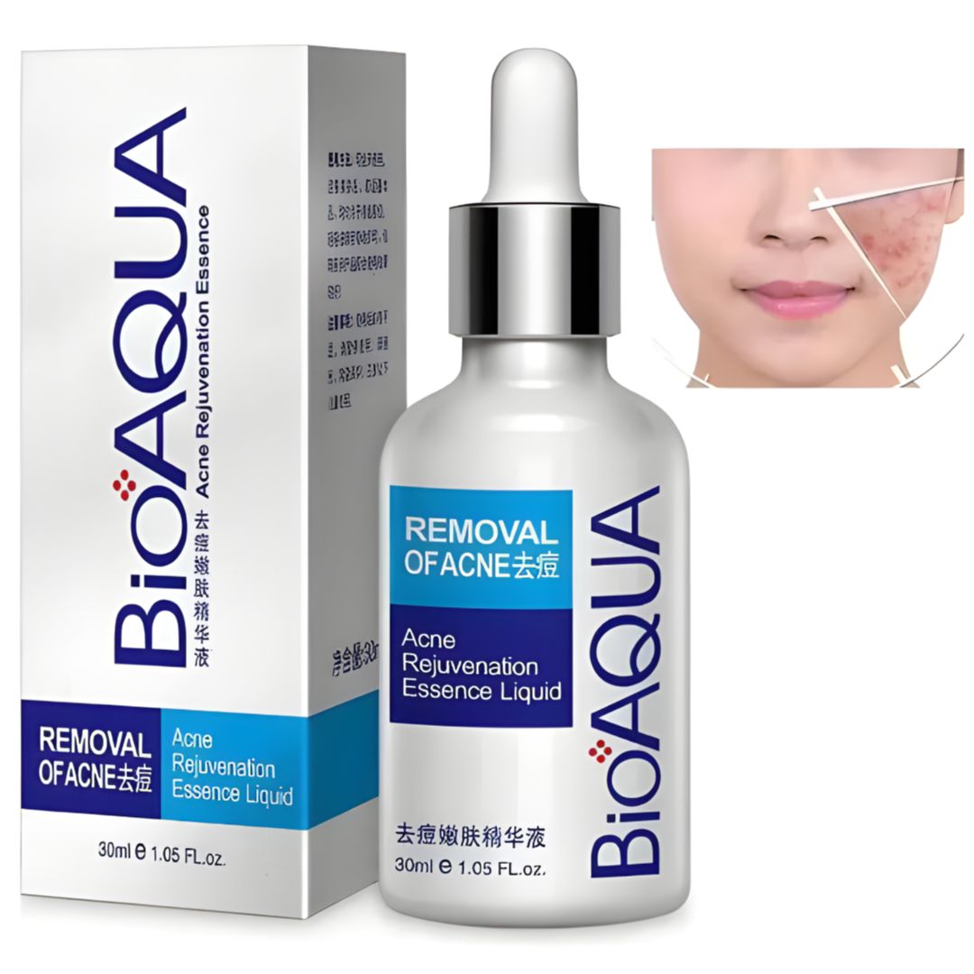 SERUM REMOVEDOR DE ACNE PS BIOAQUA